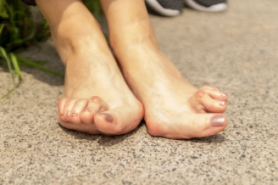 Joint Pain in Feet May Be Symptom of Rheumatoid Arthritis